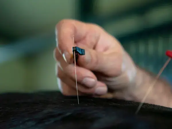 A hand placing an acupuncture needle, a clip attached to another